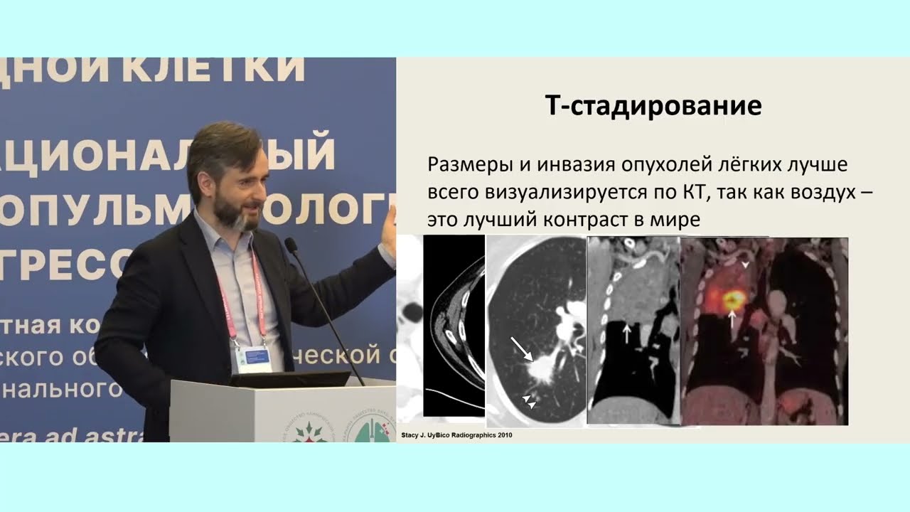 Lumos maxima: ПЭТ-КТ при лучевой терапии рака легкого. Взгляд радиолога