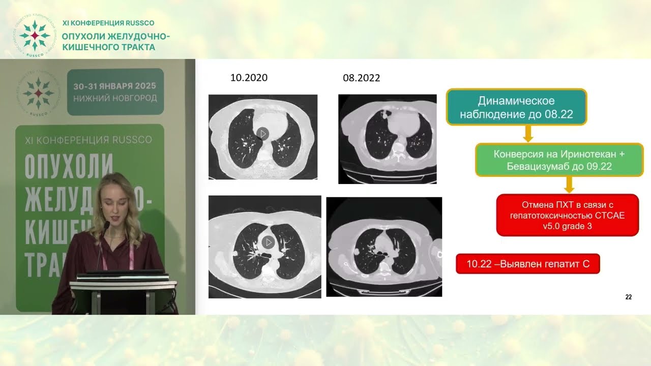 Тактика ведения пациента с опухолями ЖКТ с мультиорганными резектабельными метастазами. Рецензент
