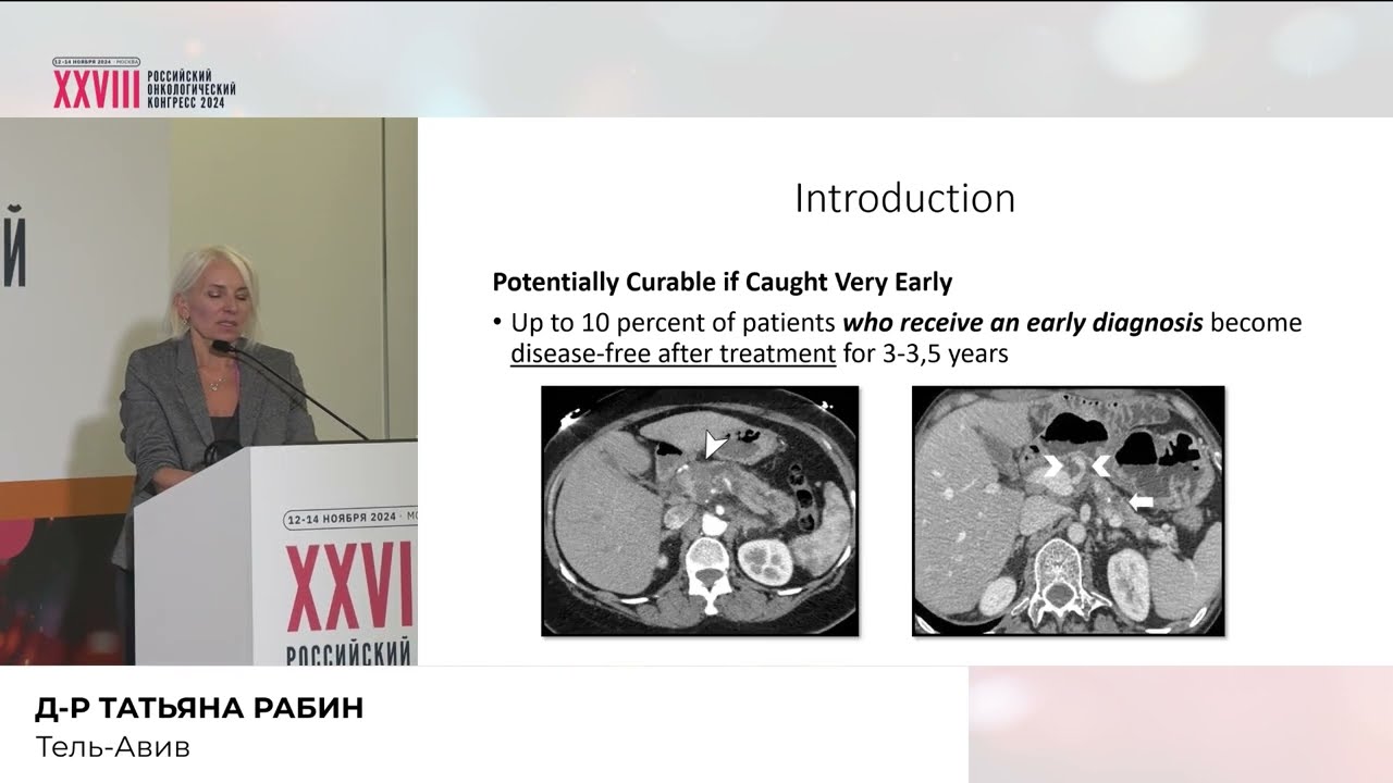 SBRT рака поджелудочной железы на MR-Linac: реальность или пока недостижимая мечта?