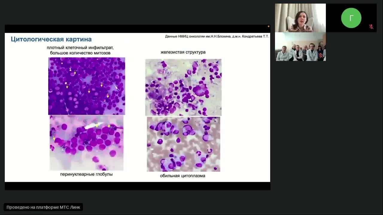 редкие опухоли. Карцинома Меркеля (вебинар 1 марта 2024)