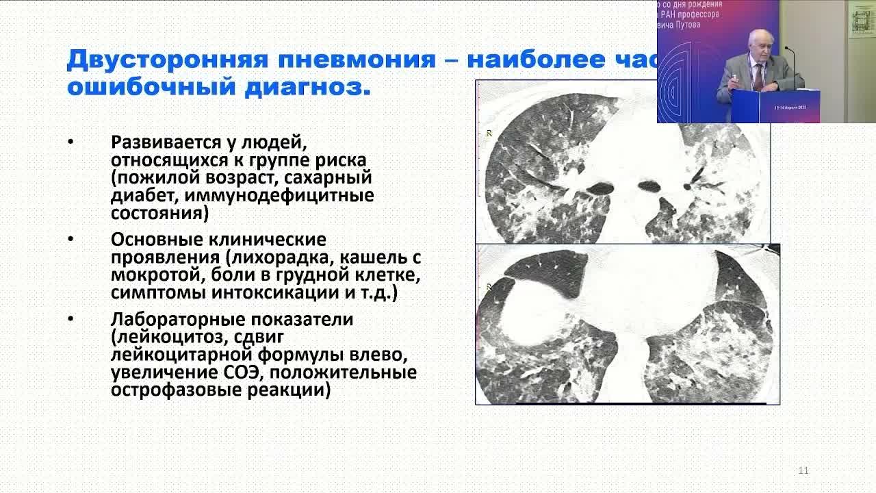 Эволюция представлений об интерстициальных заболеваниях легких