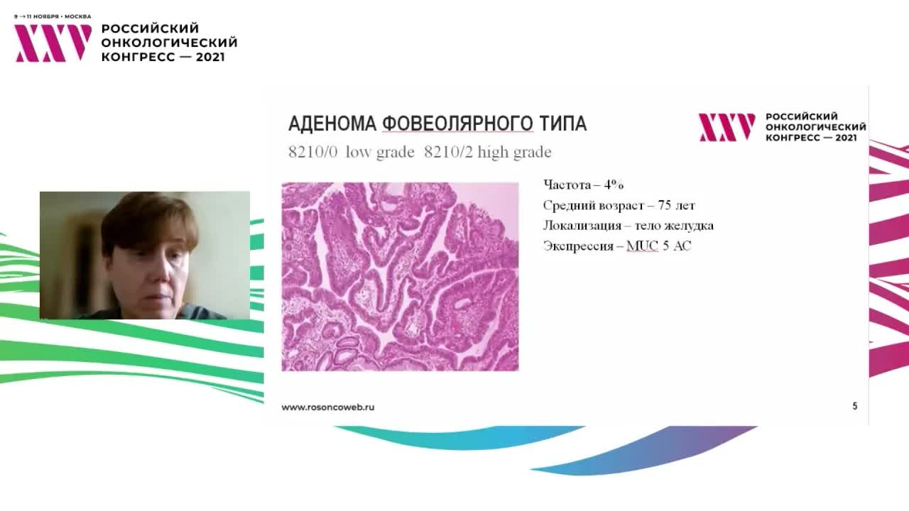 Морфологические характеристики полипов желудка
