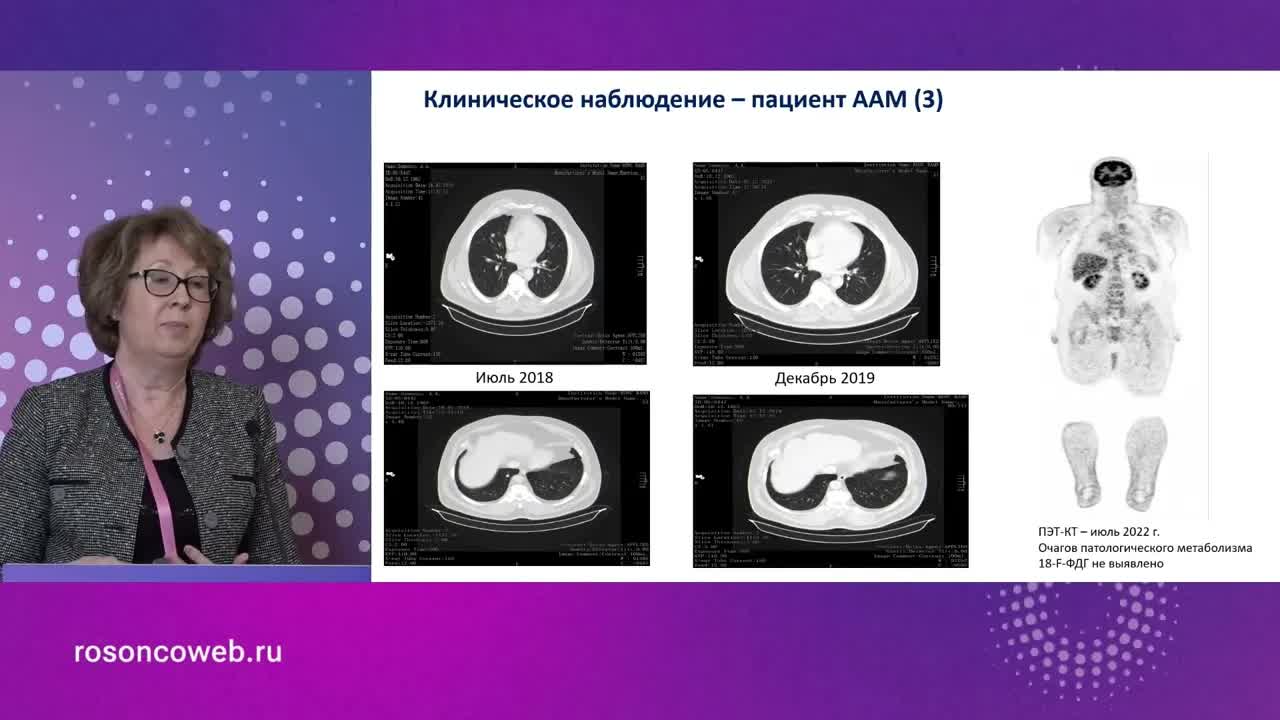 Лекарственная терапия BRAF меланомы. Минимальный объем опухоли: обсуждение кл.случая