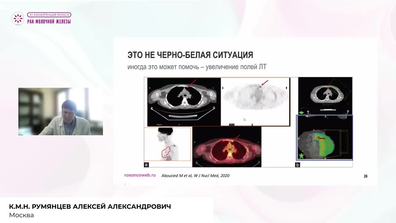 Как не нужно делать ПЭТ-КТ после радикального лечения РМЖ