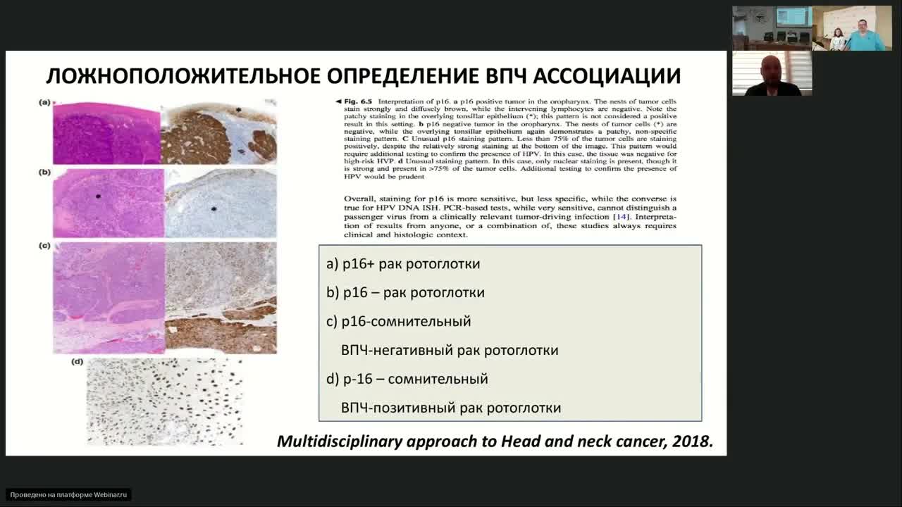 Лекарственная терапия опухолей головы и шеи (вебинар 6 октября 2023)
