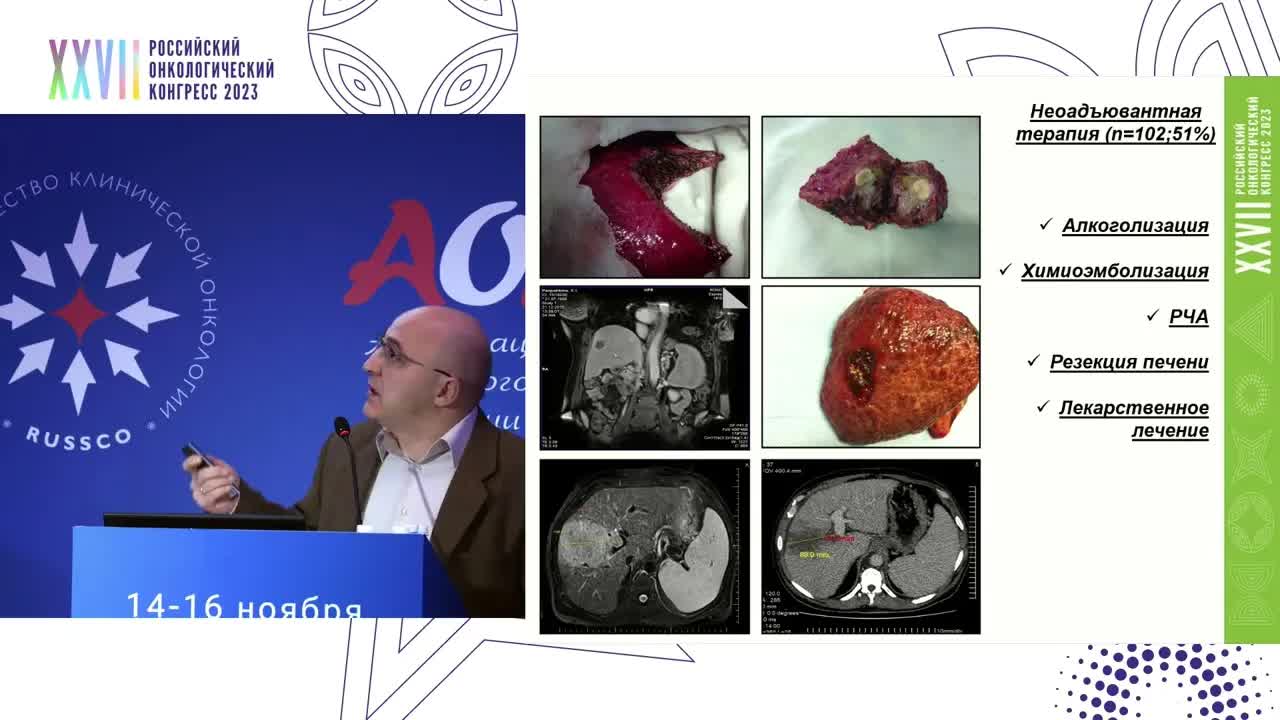 Расширение показаний для трансплантации печени при ГЦР и ХЦР