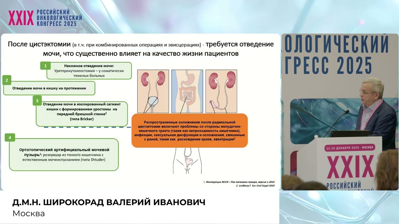 Сложная хирургия опухолей таза. Методы деривации мочи