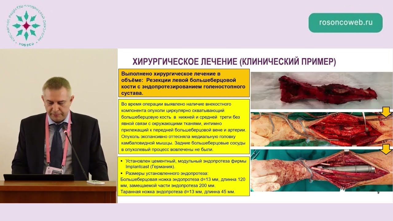 Адамантинома кости – что это и как лечить? Клинические примеры