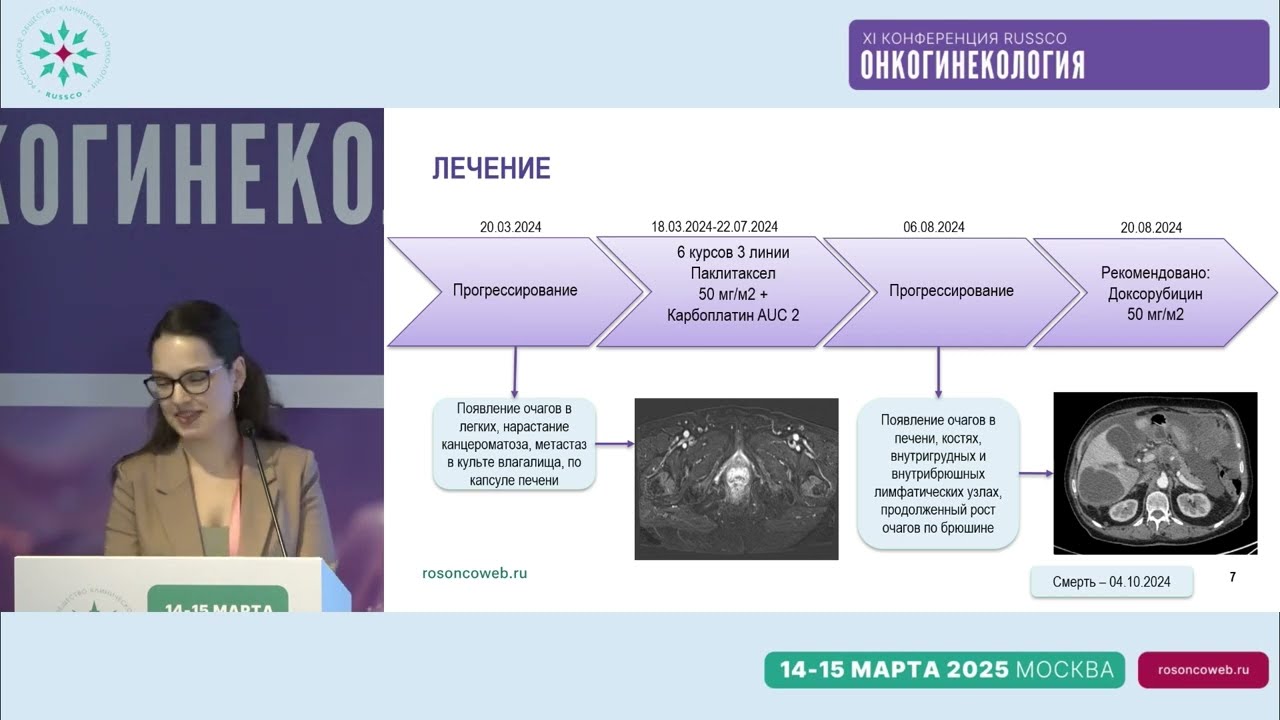 Клинический случай 4: мутация p53 при раке эндометрия