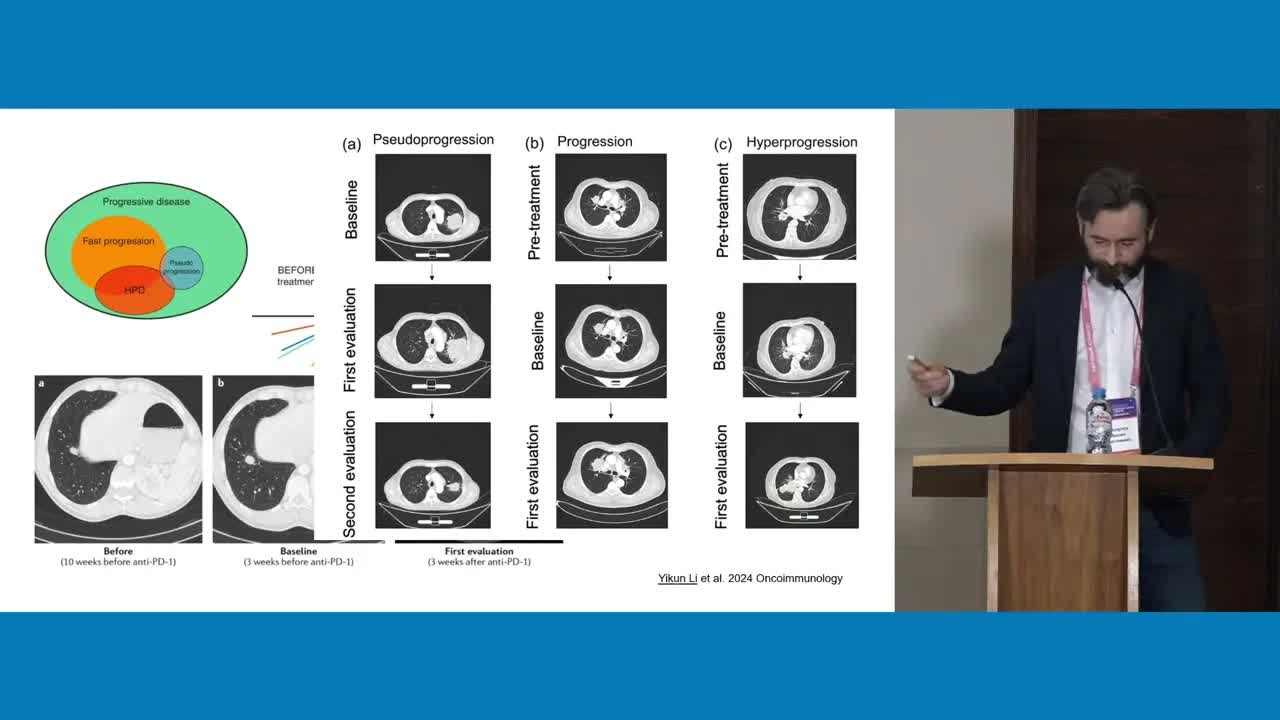 Резистентность к иммунотерапии. Причина в рентгенологе: от псевдопрогрессии до гиперпрогрессирования