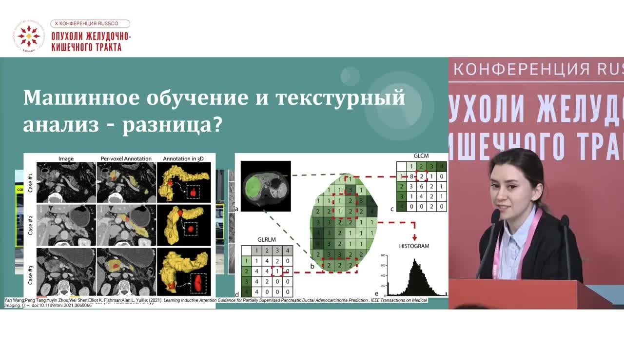 Искусственный интеллект в визуализации поджелудочной железы и ее образований по КТ-исследованиям