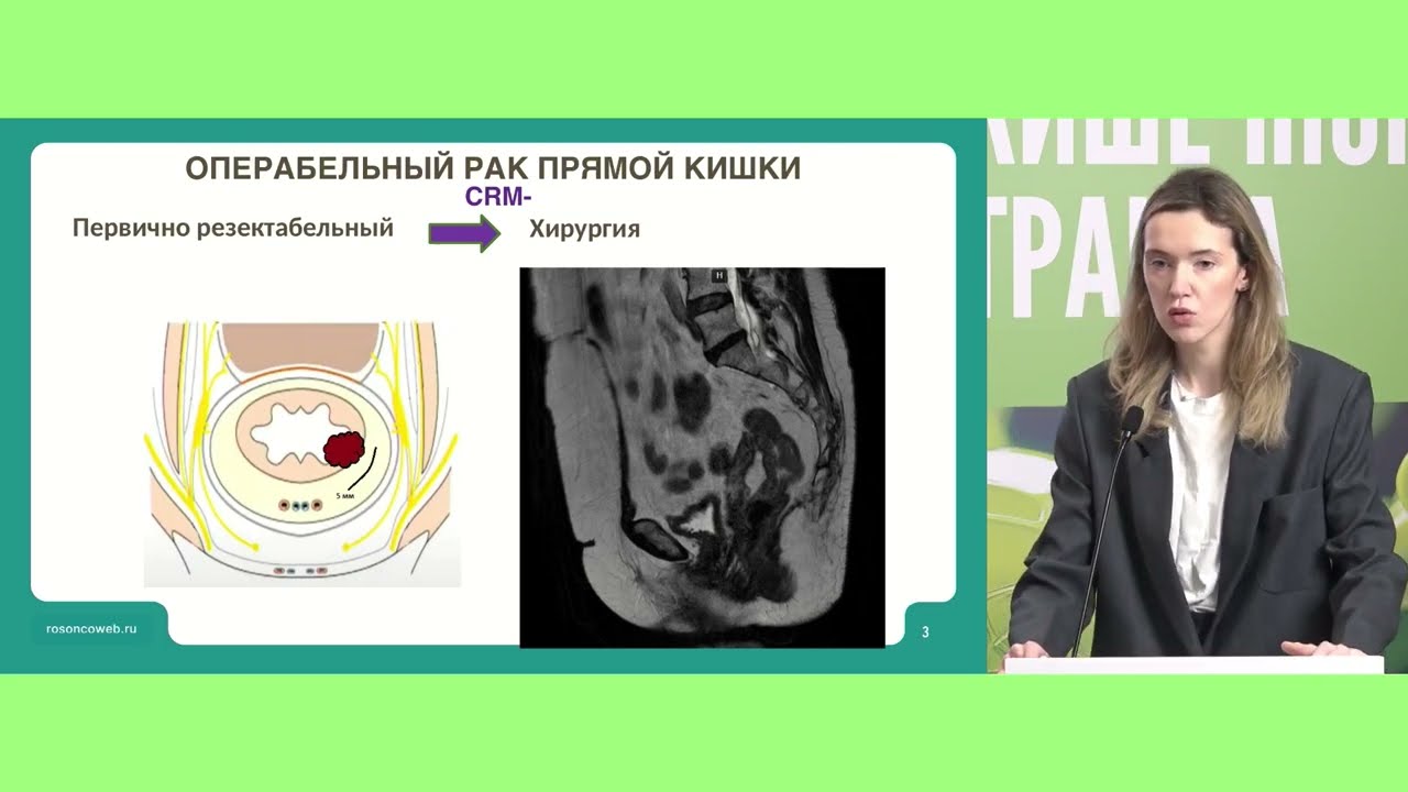 Неоадъювантная ХТ у пациентов с местнораспространенным РПК. Опыт НМИЦ онкологии им .Н.Н. Блохина