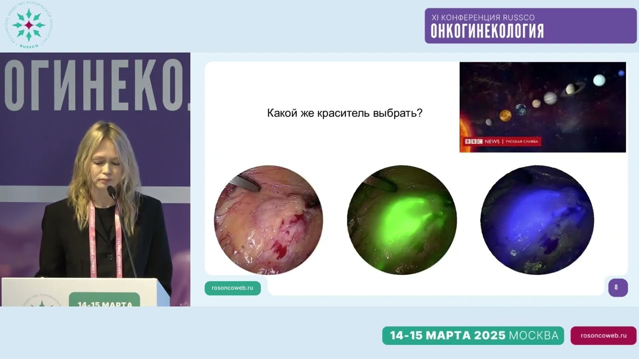  Как исследовать БСЛУ? Флуоресцентный метод