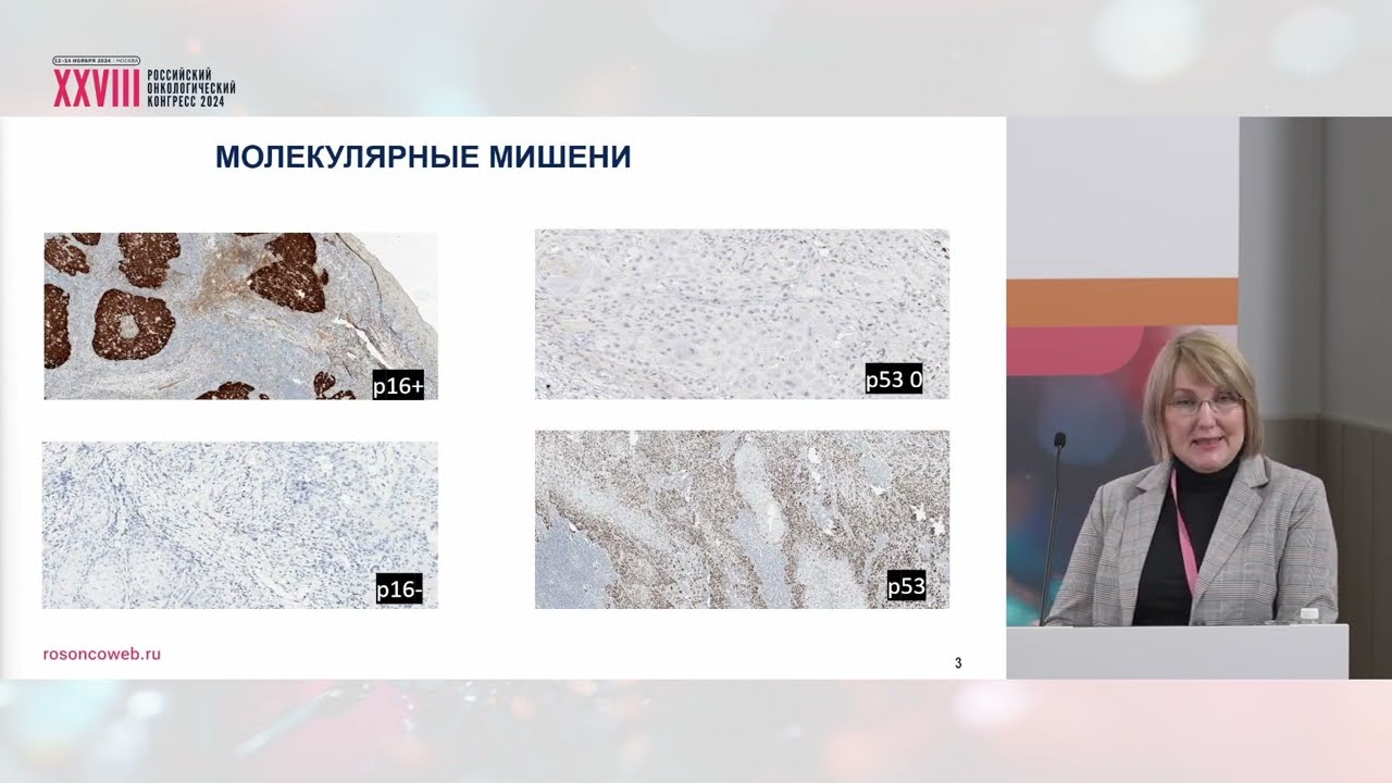 Дифференцированный подход к неоадъювантной химиотерапии рака полости рта и ротоглотки 