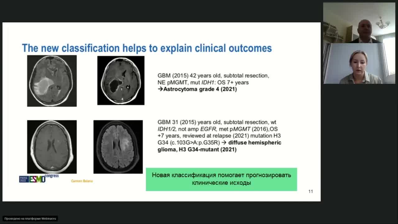 Подготовка к экзамену ESMO. Опухоли головного мозга