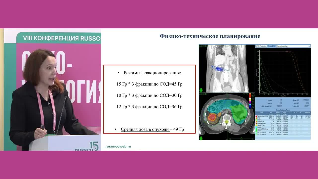 Стереотаксическая лучевая терапия у пациентов с T1b распространенностью почечноклеточного рака