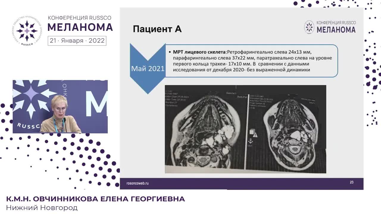 Сложный пациент: 2+ линия терапии меланомы