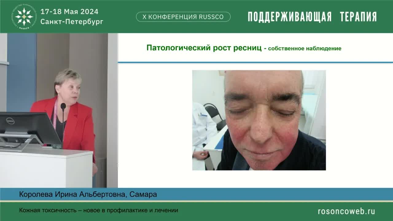 Кожная токсичность – новое в профилактике и лечении