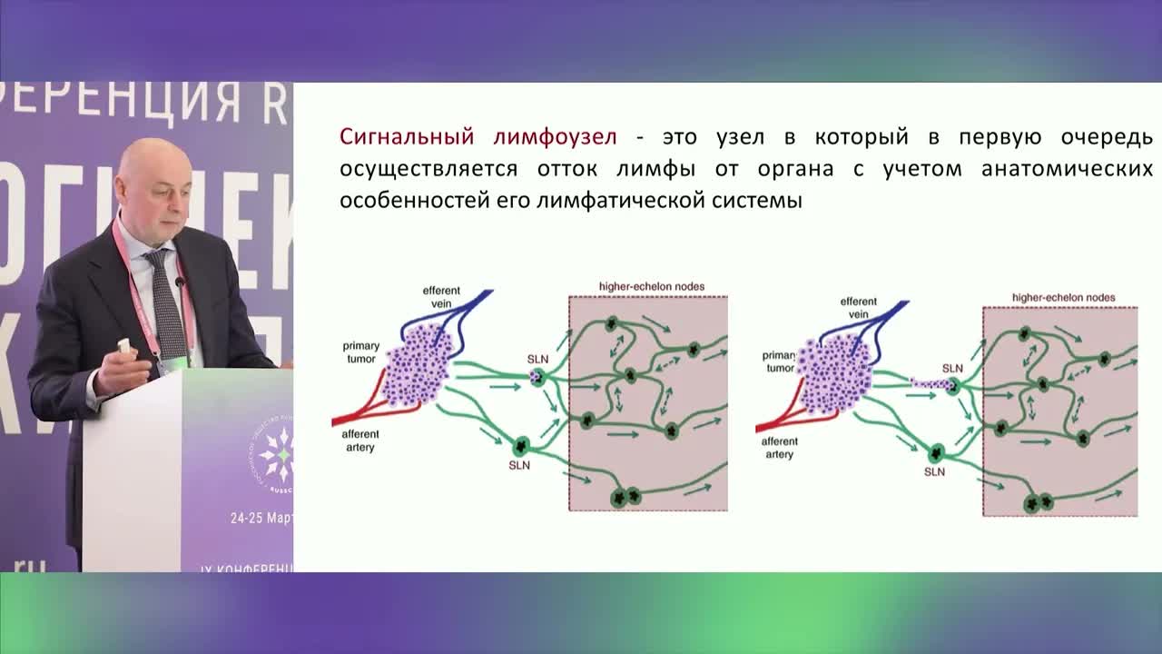 Лимфаденэктомия или биопсия сторожевых лимфатических узлов, зло во благо?