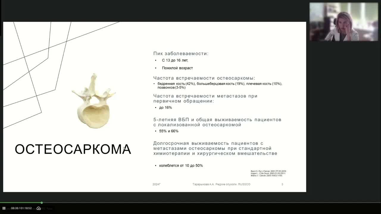 редкие опухоли. Опухоли костей (вебинар 22 мая 2024)