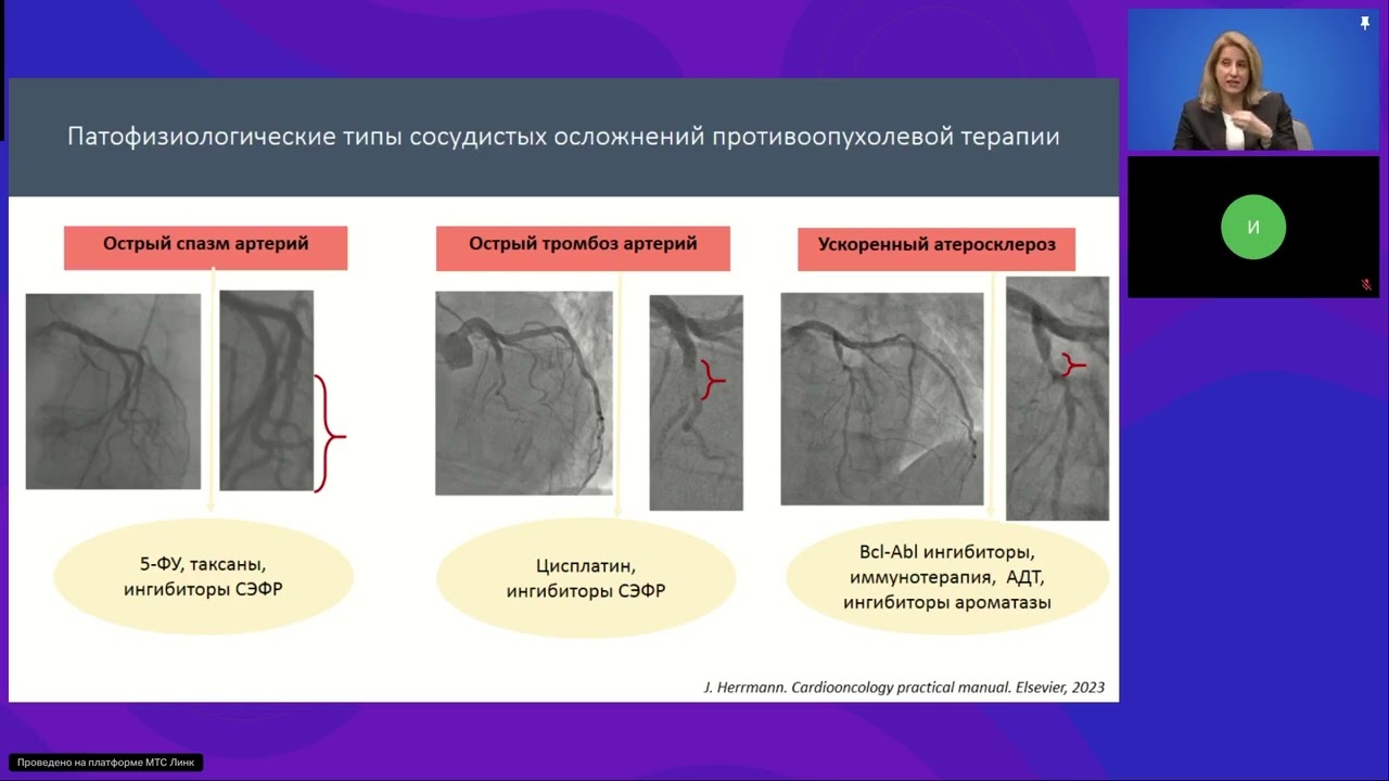 Мифы и реальность: иммунотаргетная терапия и острые артериальные тромбозы (вебинар 31 января 2025)