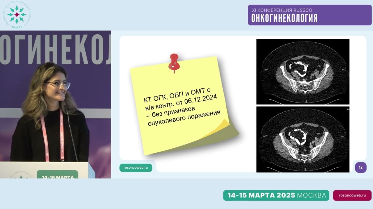 Работа химиотерапевта помогает хирургу и наоборот. Обсуждение на примерах клинических случаев
