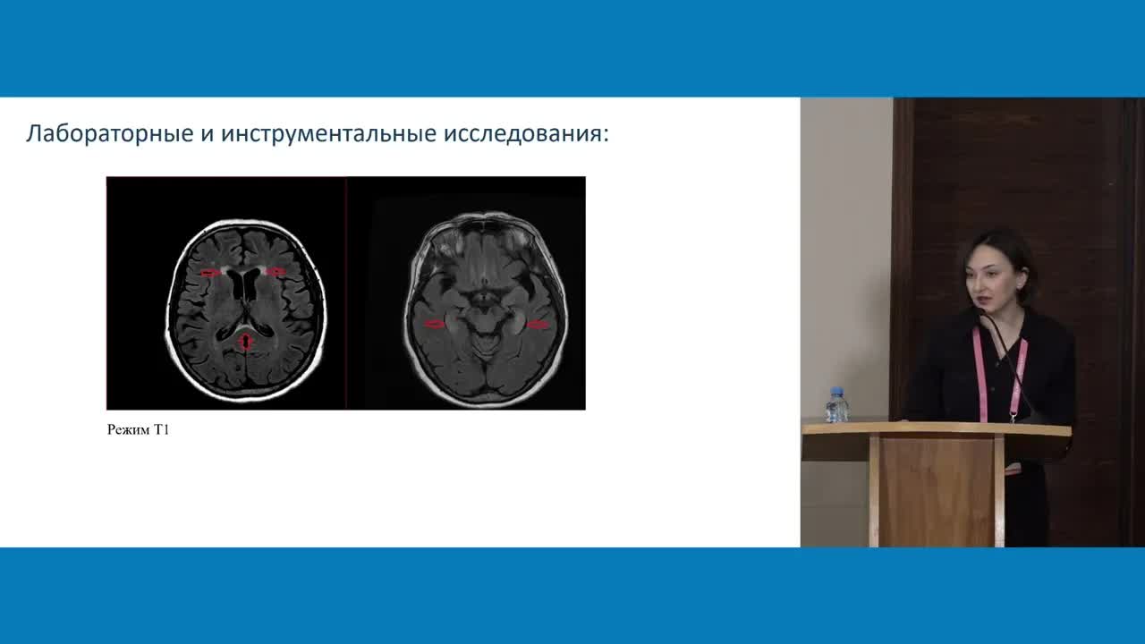 Разбор клинических наблюдений токсичности иммунотерапии. Головокружение от успехов