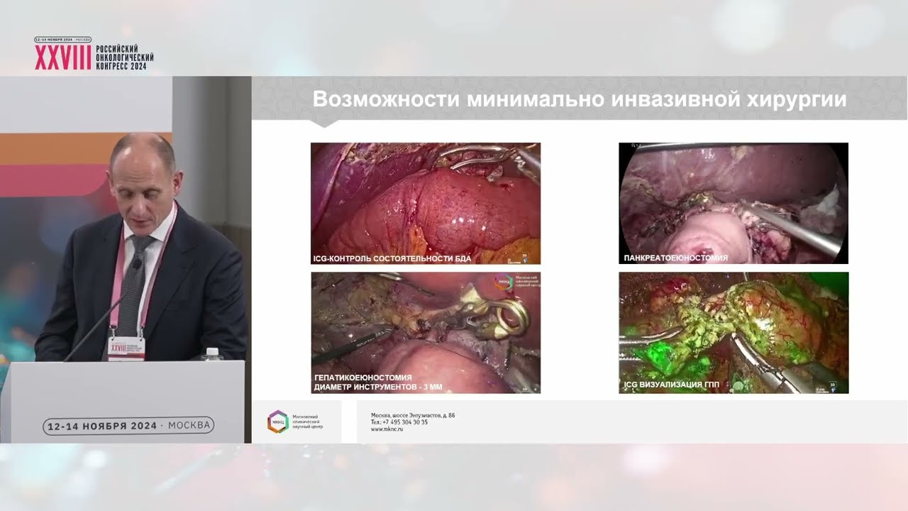 Стратегия лечения рака поджелудочной железы. Что меняется?