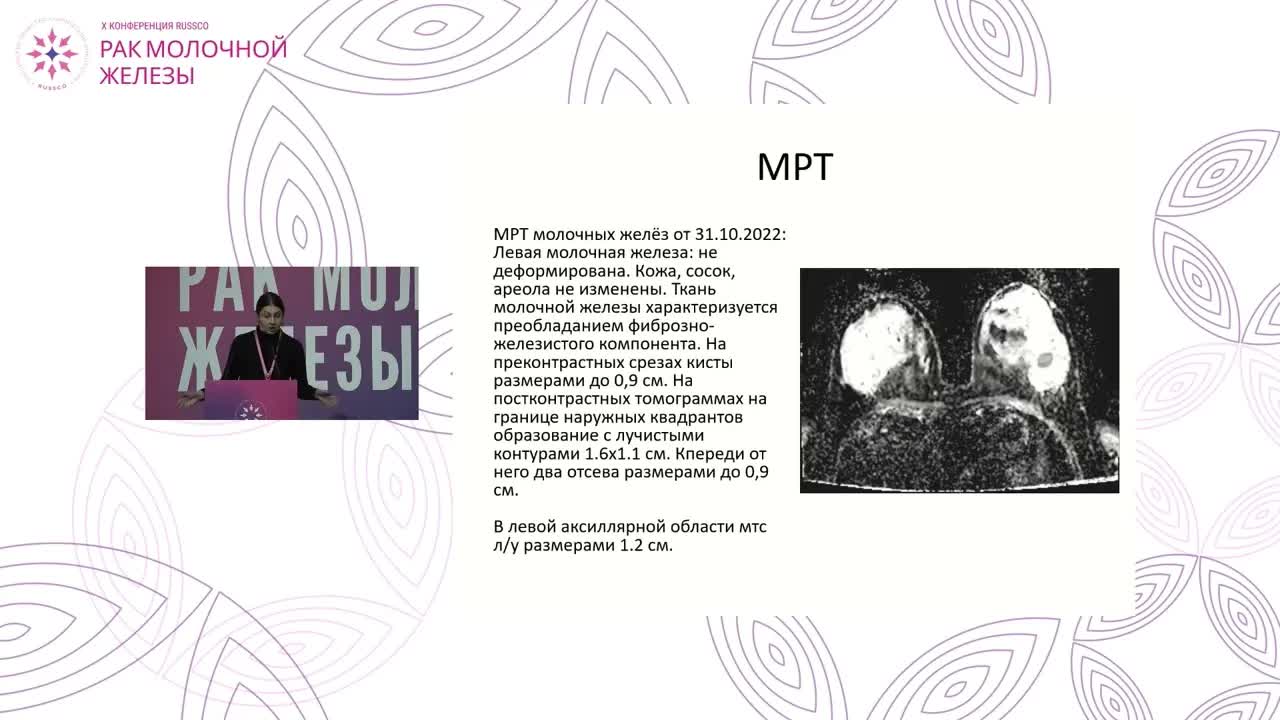 Интерактивный мультидисциплинарный разбор клинического случая РМЖ