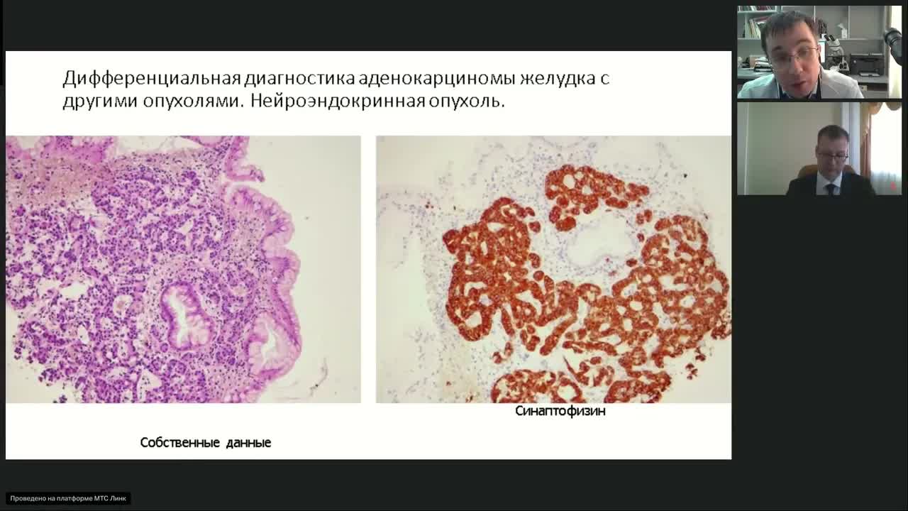 Поддерживающая терапия в онкологии (вебинар 18 апреля)