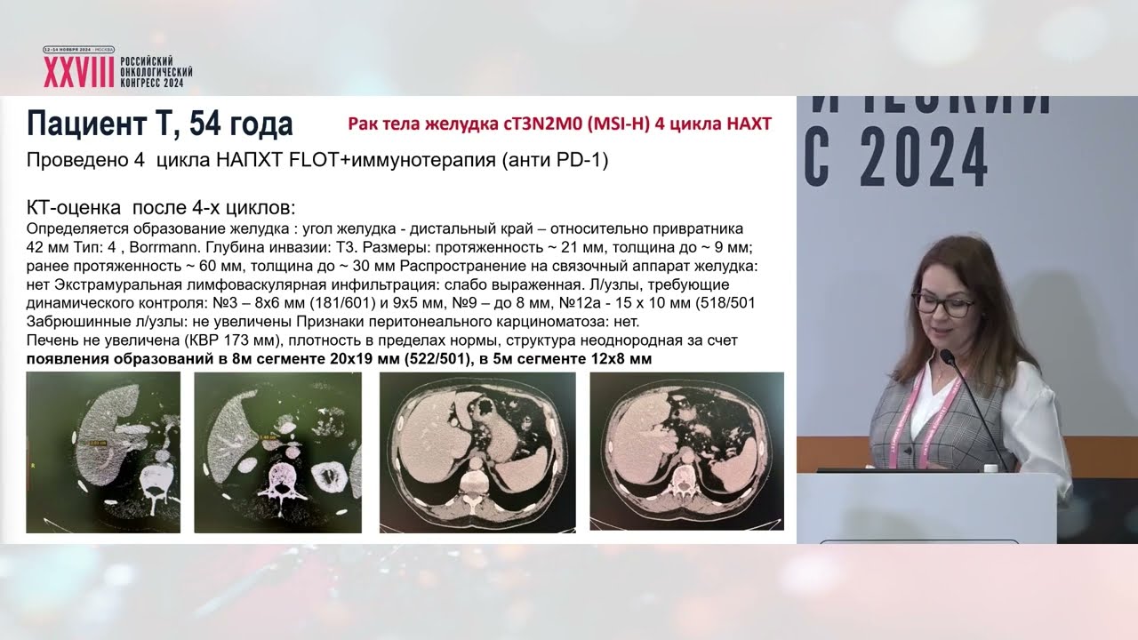 Циторедукция «вне закона». Рак желудка с dMMR
