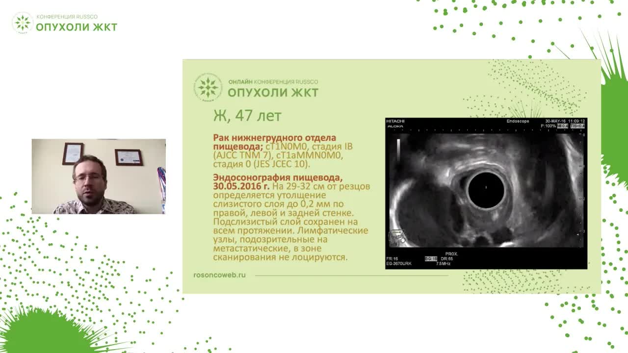 Разбор сложных клинических наблюдений, или когда лучевые терапевты отказываются облучать
