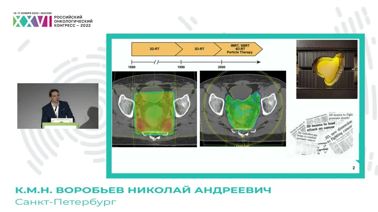 Операбельный рак предстательной железы: взгляд лучевого терапевта
