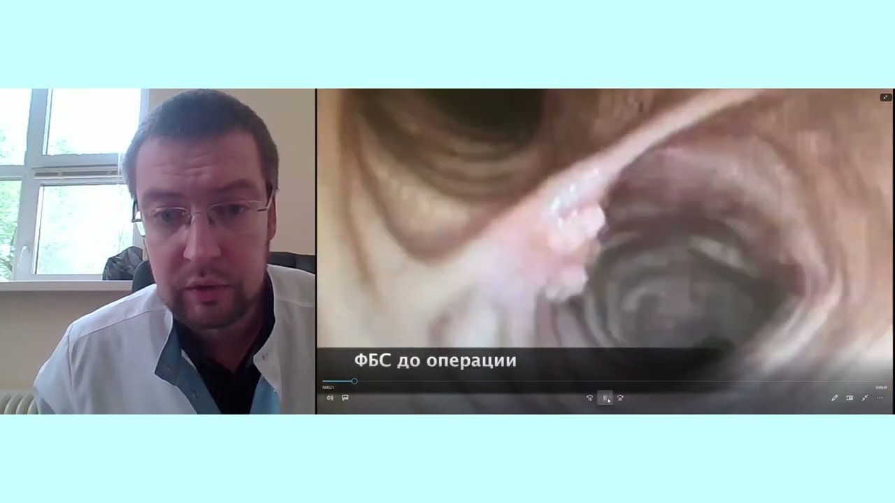 Хирургия трахеи: Паршин А.В.