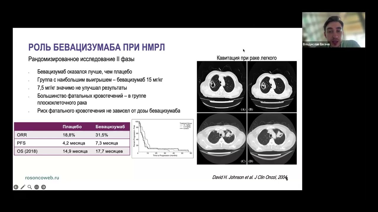 Академия RUSSCO для подготовки к экзамену ESMO: Рак легкого. Часть 1 (7 сентября 2025)