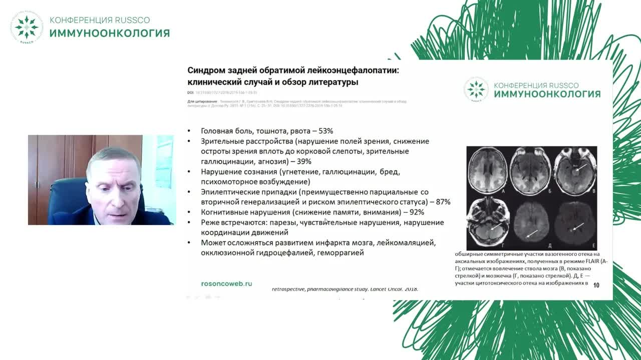 Осложнения иммунотерапии. Тяжелые нейропатии: миф или реальность?