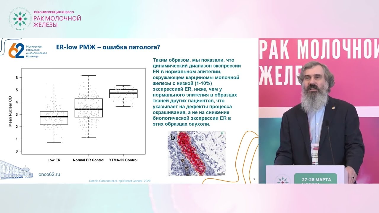 ER-low РМЖ – новый подтип? Как диагностировать