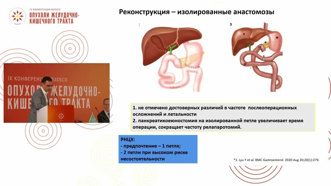 Панкреатодуоденальная резекция при раке головки поджелудочной железы: современные аспекты операции