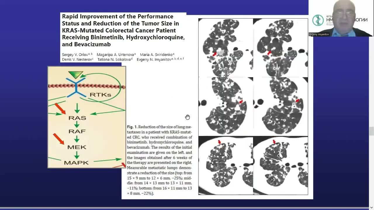 Сложные вопросы молекулярной диагностики меланомы