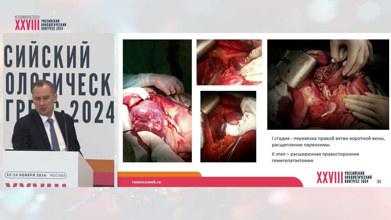 Хирургические методы в онкологии – что поменялось?