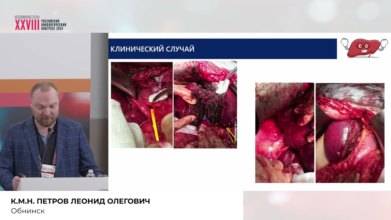 Комбинированное лечение больных первичным раком печени: возможности НМИЦ радиологии