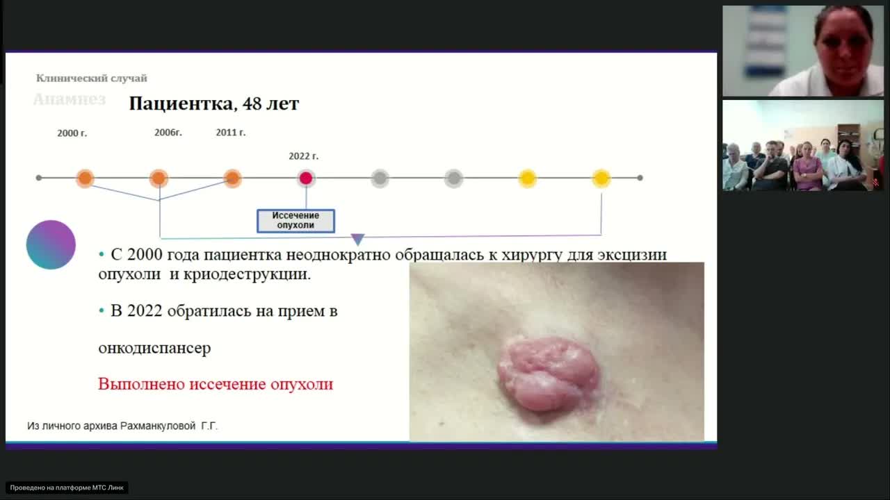 Редкие опухоли. Десмоид (вебинар 19 июня 2024)