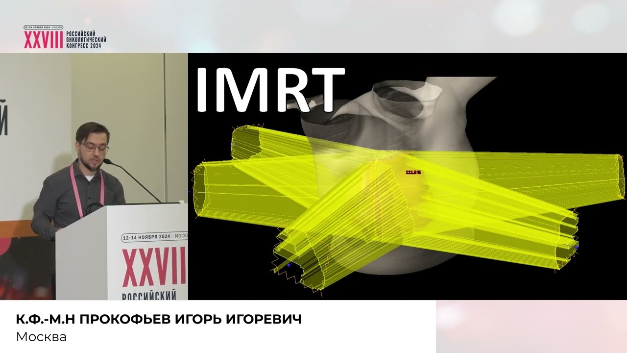 Выбор технологии планирования при лучевой терапии ЗНО молочной железы