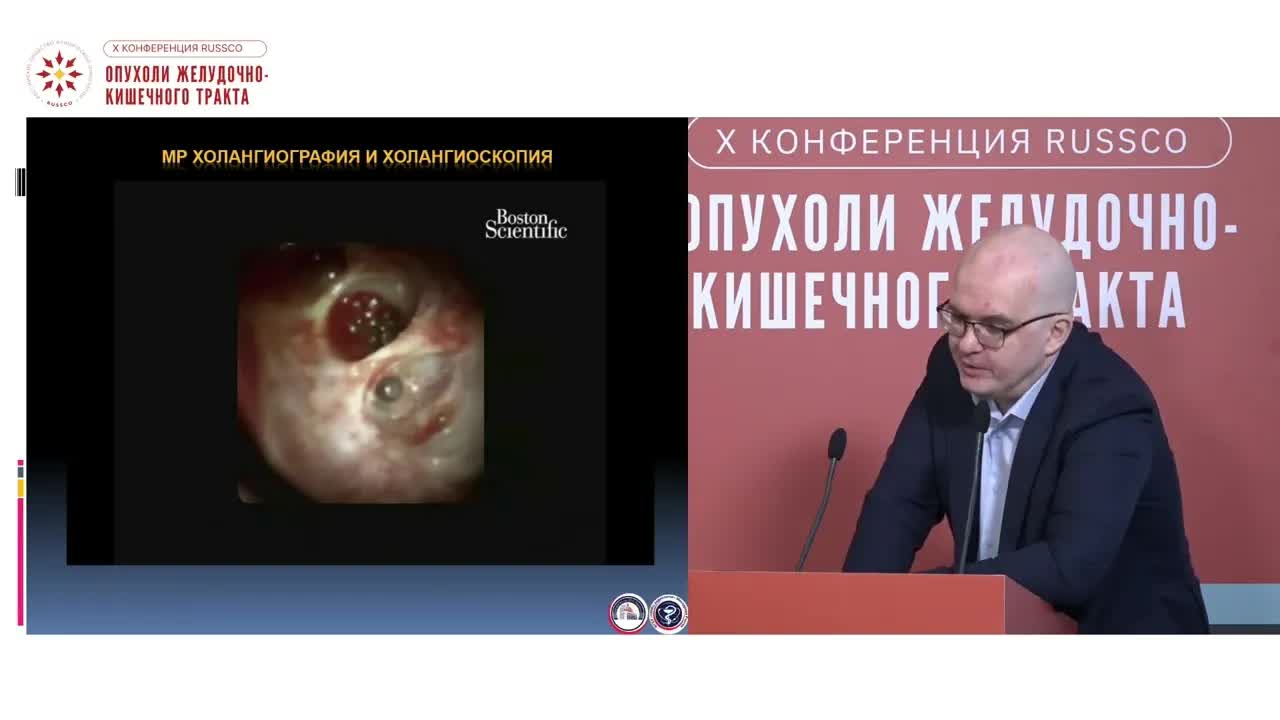 Может ли холангиоскопия изменить объем операции при опухолях внепеченочных желчных протоков?