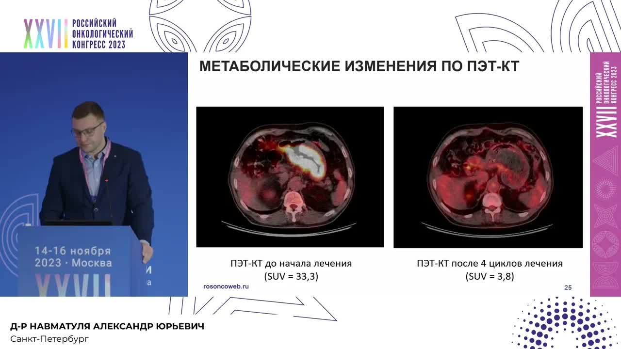 План Чемберлена, или роль неоадъювантной ХТ в лечении местнораспространненного рака желудка
