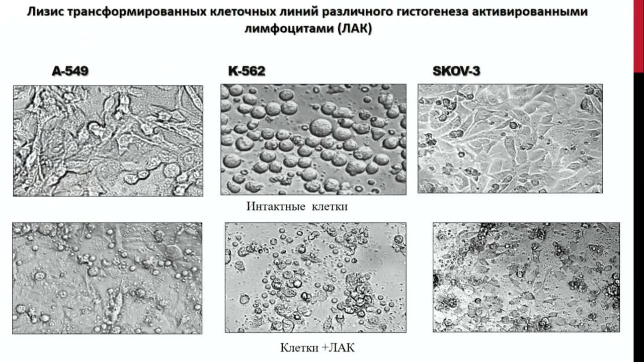 Генетически модифицированные T-NK клетки с химерным Т-клеточным рецептором при солидных опухолях