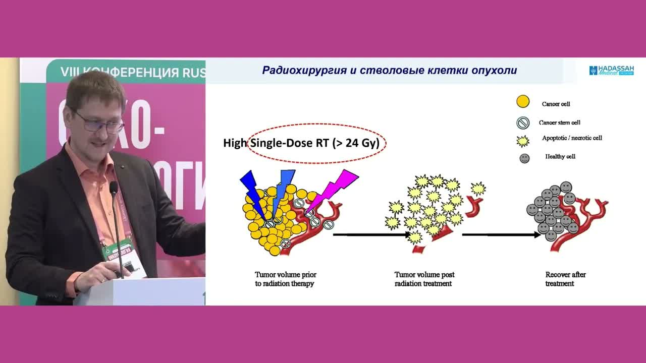 Метастаз-направленная терапия при олигометастазах рака предстательной железы. Update 2026