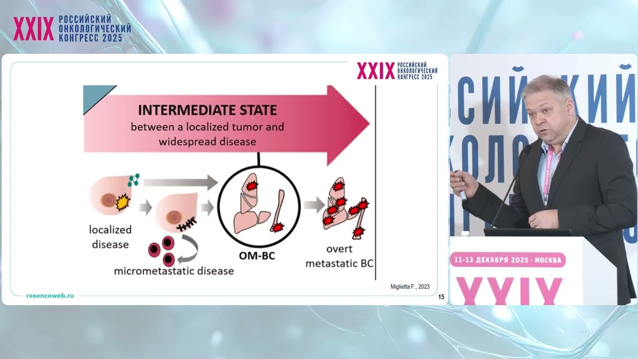 Олигометастатический рак: лечим системно или локально?