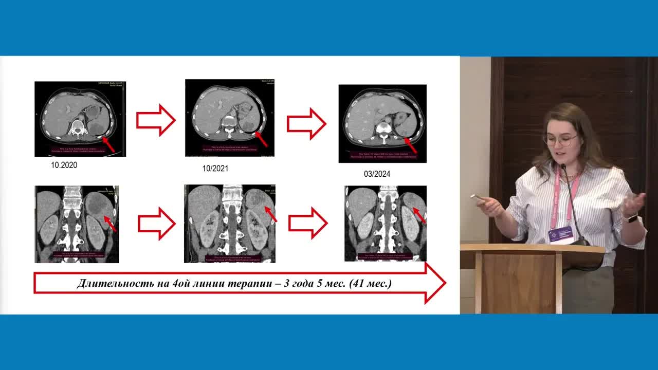 Агностическое назначение таргетной и иммунотерапии терапии в примерах: POLE
