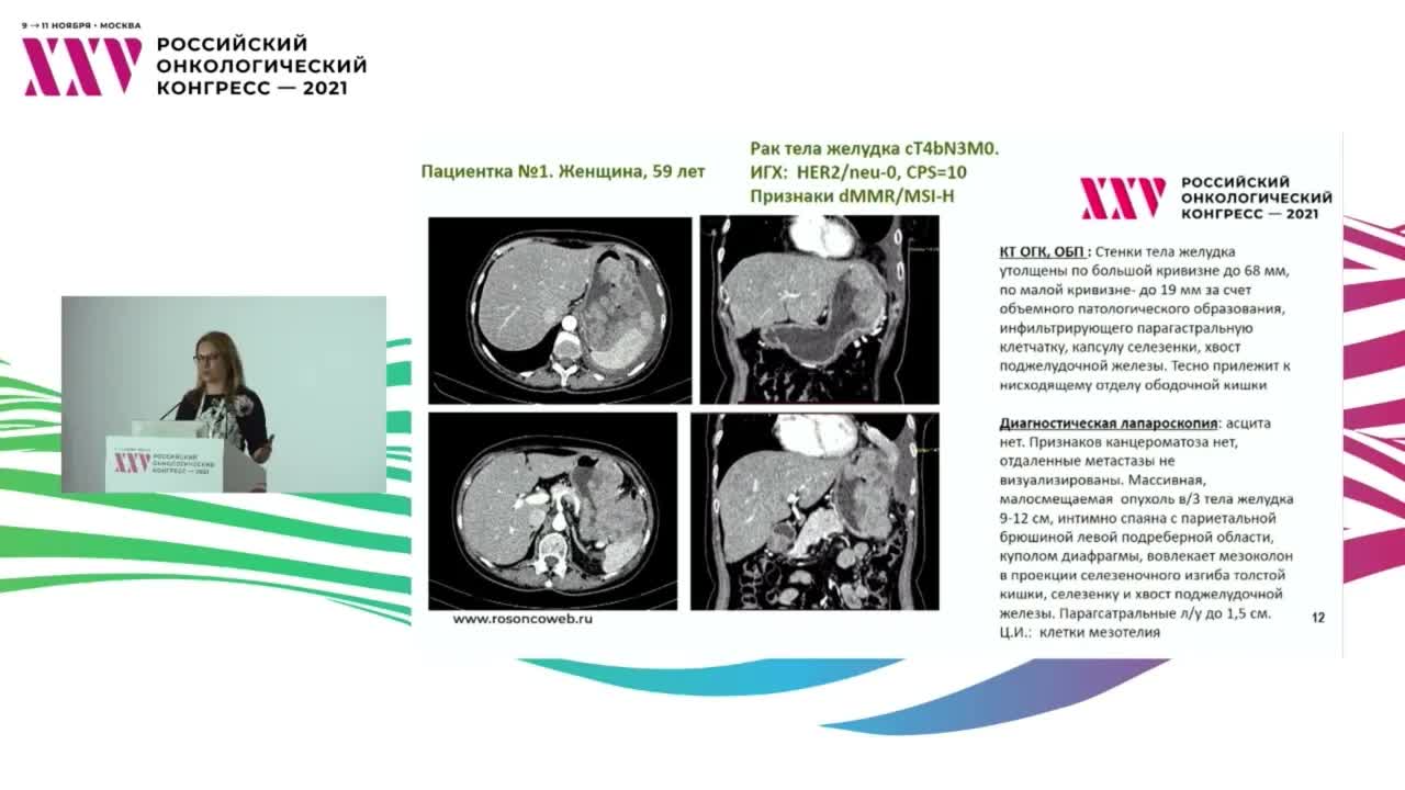 Лечение MSI-H опухолей: в каких случаях мы достигаем успеха? 